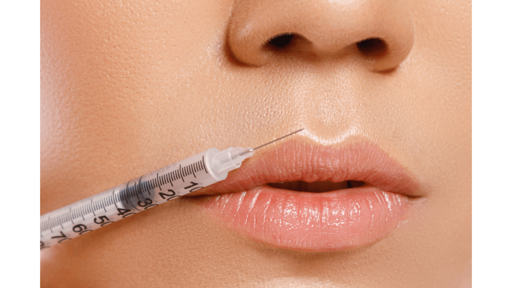belotero for lips contour filler injection