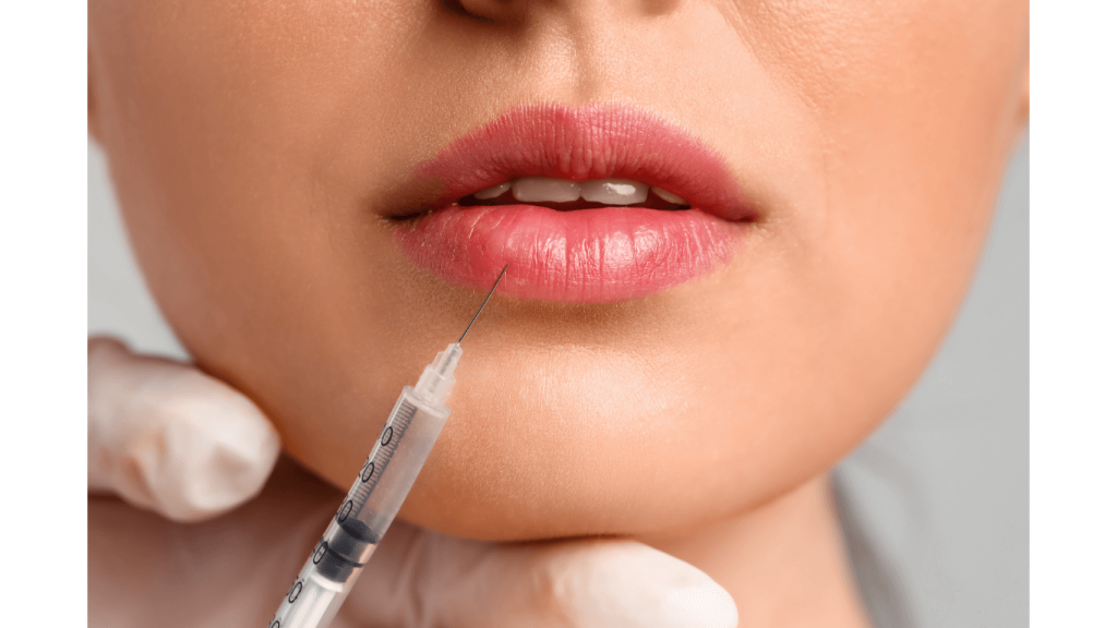 belotero lips contour treatment