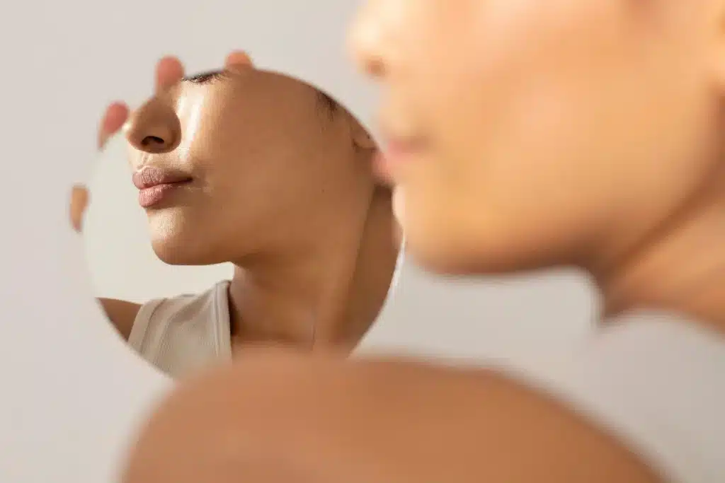 woman looking in the mirror her Sculptra chin