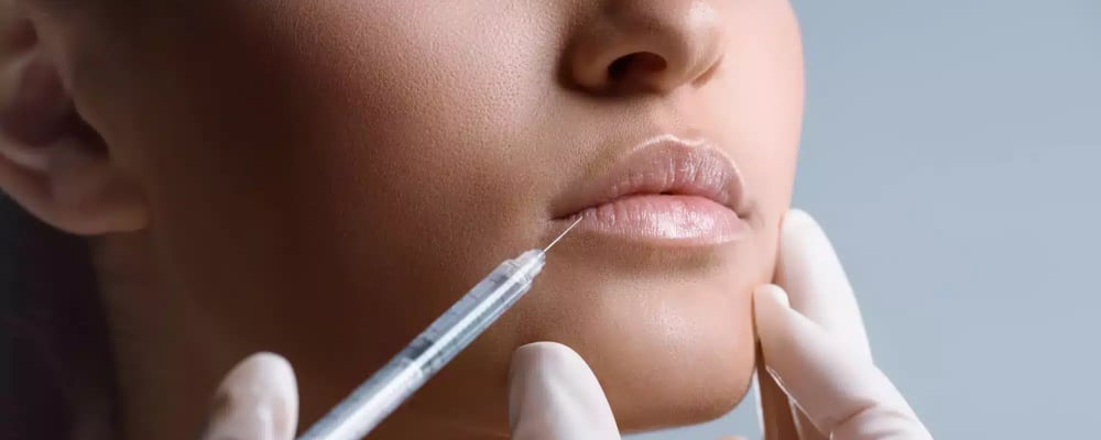 stylage filler for lips
